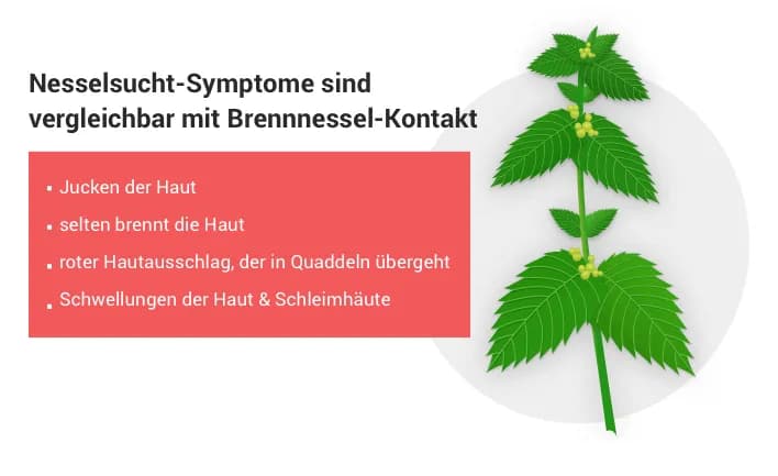 Medikamente gegen Nesselsucht: Effektive Lösungen für juckende Quaddeln