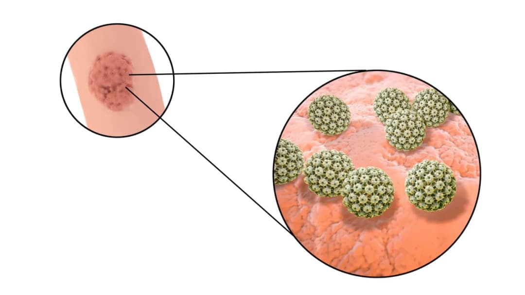 Symptome von Geschlechtskrankheiten: Warnsignale, die Sie kennen sollten