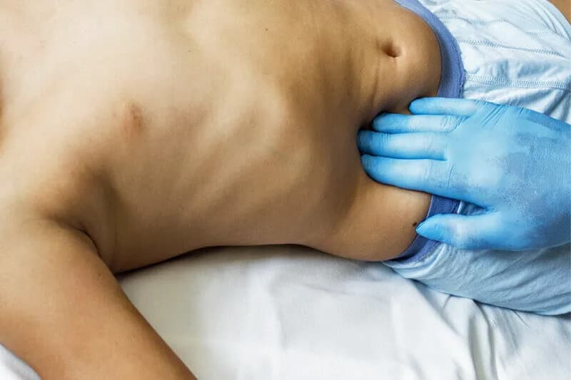 Wichtige Symptome einer Blinddarmentzündung: So erkennen Sie sie rechtzeitig